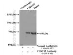 CHST15 Antibody in Immunoprecipitation (IP)