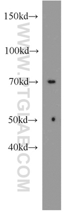 CHST15 Antibody in Western Blot (WB)