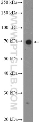 CHST15 Antibody in Western Blot (WB)