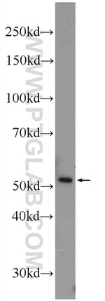 SCRN1 Antibody in Western Blot (WB)