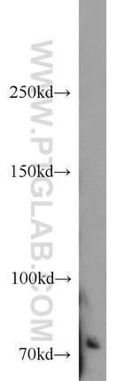 ACK1 Antibody in Western Blot (WB)