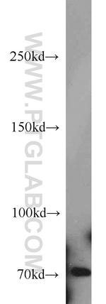 ACK1 Antibody in Western Blot (WB)