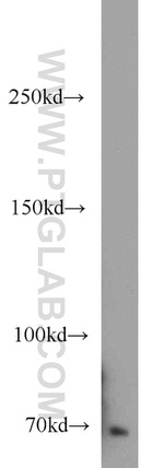 ACK1 Antibody in Western Blot (WB)
