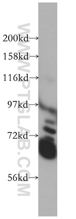 GAN Antibody in Western Blot (WB)