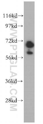 GAN Antibody in Western Blot (WB)