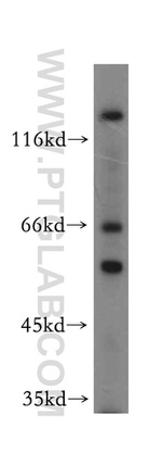 WASL Antibody in Western Blot (WB)