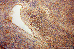 CDC16/APC6 Antibody in Immunohistochemistry (Paraffin) (IHC (P))