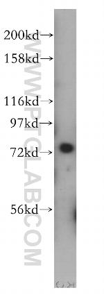 CDC16/APC6 Antibody in Western Blot (WB)
