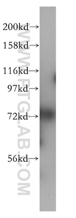CDC16/APC6 Antibody in Western Blot (WB)