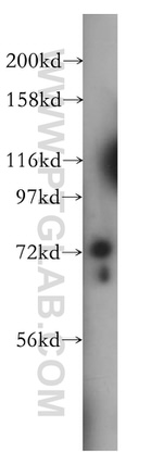 CDC16/APC6 Antibody in Western Blot (WB)