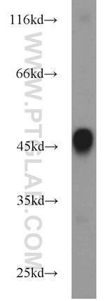 KRT36 Antibody in Western Blot (WB)
