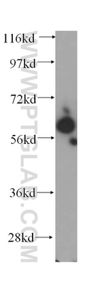 SLC38A3 Antibody in Western Blot (WB)