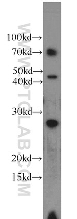 SOD3 Antibody in Western Blot (WB)