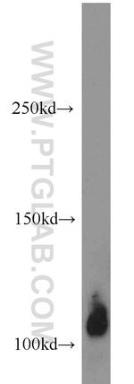 Thrombomodulin Antibody in Western Blot (WB)
