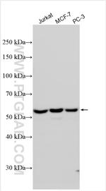 TSEN54 Antibody in Western Blot (WB)