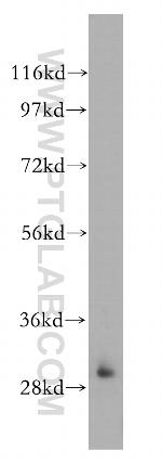 HOXC4 Antibody in Western Blot (WB)