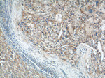 MICB Antibody in Immunohistochemistry (Paraffin) (IHC (P))