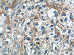 MICB Antibody in Immunohistochemistry (Paraffin) (IHC (P))