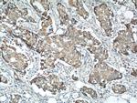MICB Antibody in Immunohistochemistry (Paraffin) (IHC (P))