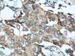 MICB Antibody in Immunohistochemistry (Paraffin) (IHC (P))