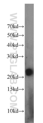 RHOB Antibody in Western Blot (WB)