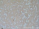 RHOB Antibody in Immunohistochemistry (Paraffin) (IHC (P))