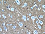 RHOB Antibody in Immunohistochemistry (Paraffin) (IHC (P))