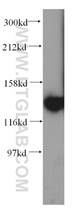 NOMO2 Antibody in Western Blot (WB)