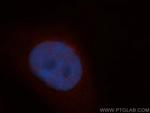 ADAR1 Antibody in Immunocytochemistry (ICC/IF)