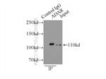 ADAR1 Antibody in Immunoprecipitation (IP)