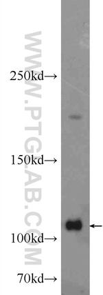 ADAR1 Antibody in Western Blot (WB)