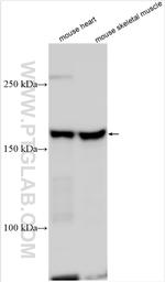 PPIP5K1 Antibody in Western Blot (WB)
