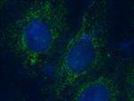 KIF3C Antibody in Immunocytochemistry (ICC/IF)