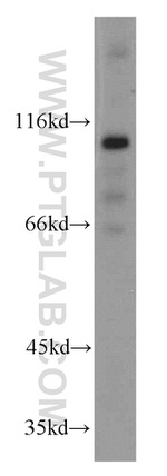 KIF3C Antibody in Western Blot (WB)