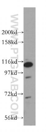 KIF3C Antibody in Western Blot (WB)