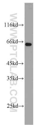CADM1 Antibody in Western Blot (WB)