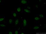 HLX Antibody in Immunocytochemistry (ICC/IF)