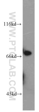 Collagen Type XXIII Antibody in Western Blot (WB)