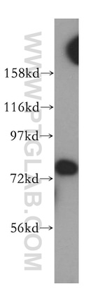 Collagen Type XXIII Antibody in Western Blot (WB)