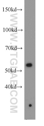 MAPKAPK5 Antibody in Western Blot (WB)