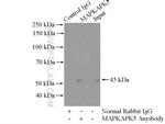 MAPKAPK5 Antibody in Immunoprecipitation (IP)