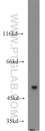 MAPKAPK5 Antibody in Western Blot (WB)