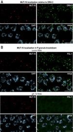 GFP Antibody in Immunocytochemistry (ICC/IF)