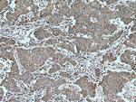 PALB2 Antibody in Immunohistochemistry (Paraffin) (IHC (P))