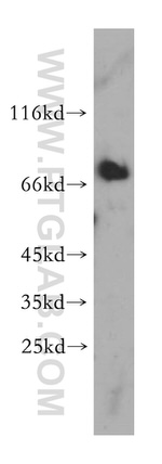 MAVS/VISA Antibody in Western Blot (WB)