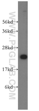 VBP1 Antibody in Western Blot (WB)