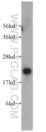 VBP1 Antibody in Western Blot (WB)