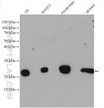 VBP1 Antibody in Western Blot (WB)