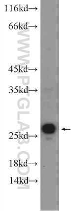 VBP1 Antibody in Western Blot (WB)