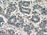 USP1 Antibody in Immunohistochemistry (Paraffin) (IHC (P))